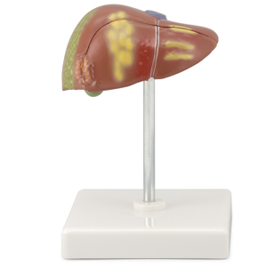 Altay® Human Liver Pathology Model