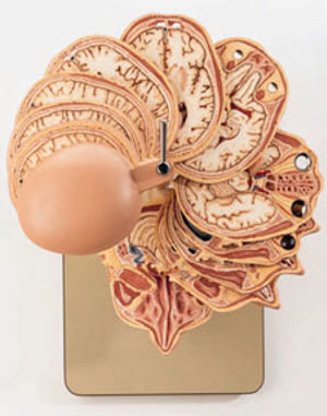 Horizontally Sectioned Human Head