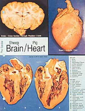 Brain Diss Chart