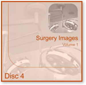 Surgery Images