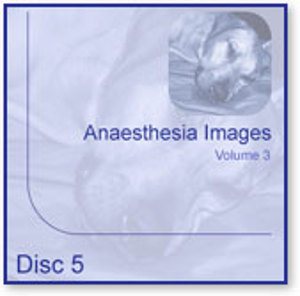 Anaesthesia Image