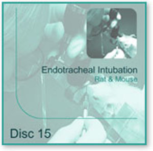 Endotracheal Intubation