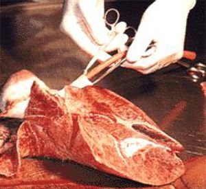 Pulsating Organ Perfusion (Surg)