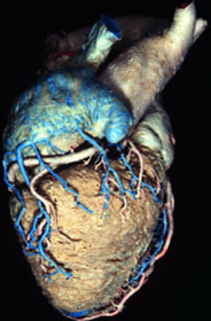 The Heart in Depth (Neotek) The Heart in Depth (Neotek)