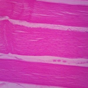 Human Muscle Tissues Microscope Slide Set