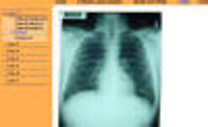 Learning Lung Sounds (5823) Learning Lung Sounds (5823)