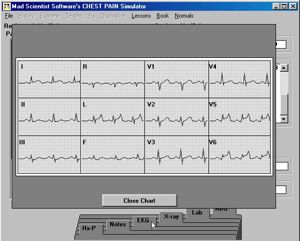 Chest Pain Simulator 5919 Chest Pain Simulator 5919