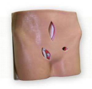 Hernia Model 9014 Hernia Model 9014