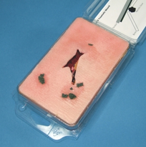 BSS Traumatic Wound 9273 BSS Traumatic Wound 9273