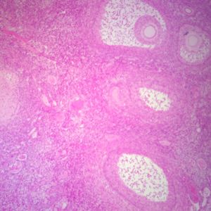 Female Reproductive System Microscope Slides Female Reproductive System Microscope Slides