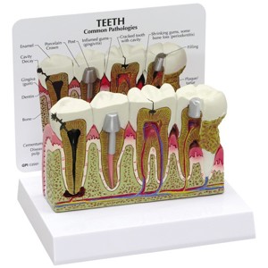Teeth – Model Teeth – Model