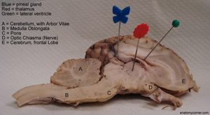 Anatomy Corner Sheep Brain