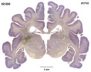 Brain Biodiversity Bank Atlases Polar Bear Brain Biodiversity Bank Atlases Polar Bear