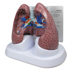 Lung Set With Pathologies – Model