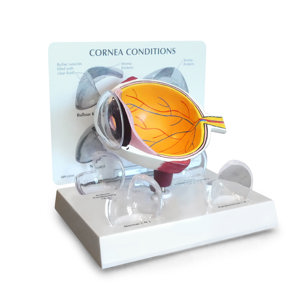 Cornea Eye – Model By GPI Anatomicals Cornea Eye – Model By GPI Anatomicals