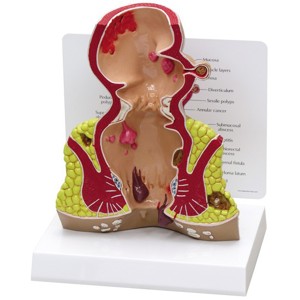 Rectum By GPI Anatomicals