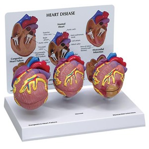 3 Mini Heart Set 3 Mini Heart Set