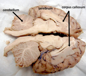 rat brain dissection diagram