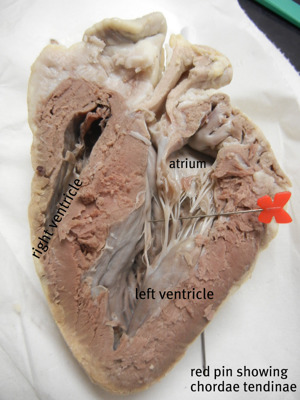 Sheep Heart Dissection (1)