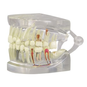 Clear Human Jaw With Teeth Clear Human Jaw With Teeth
