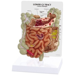 GI Tract