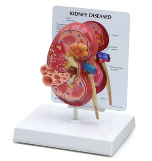 Kidney Normal:Pathology By GPI Anatomicals