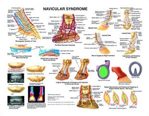 Equine Navicular Syndrome Laminated Chart