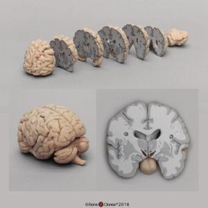 Advanced Brain Study Bundle Advanced Brain Study Bundle