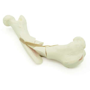 Canine Femur With Comminuted Fracture